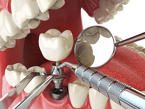 Best Emergency Orthodontic Repairs in Mount Hope, WV