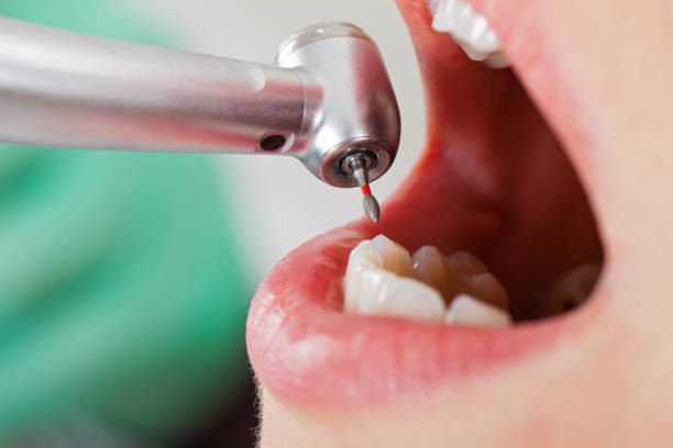 Best Emergency Treatment for Oral Infections in Mount Hope, WV
